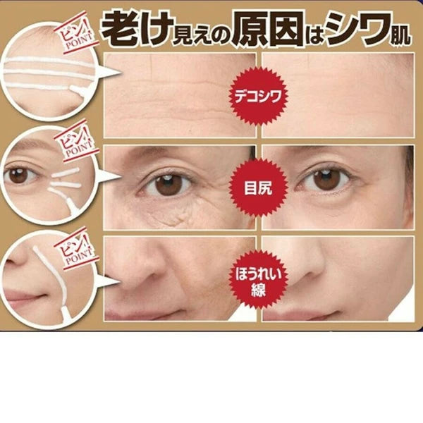 日本JP直送藥用Shiwahar EX 額頭,魚尾紋,法令紋,皺紋,藥用霜,玻尿酸,膠原蛋白 {10月30截單;預計10-14 工作天發貨}
