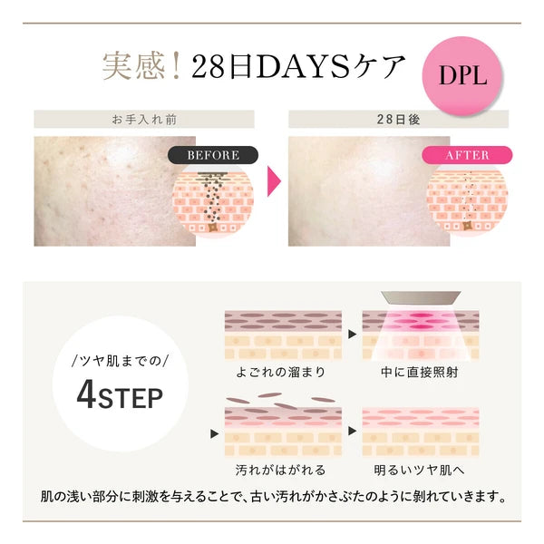 日本JP直送 WAVEWAVE Radiant Grace / 除毛,多餘毛髮護理,IPL,0.1 秒最快 IPL 光子嫩膚治療,自我除毛 {10月30截單;預計10-14 工作天發貨}