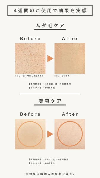 日本JP直送 脱毛器 IPL 美肌 99万回照射 ICE技術 顔 ワキ 背中 ヒゲ VIO 脱毛 美顔器 光美容器 男女兼用 家庭用 {10月30截單;預計10-14 工作天發貨}