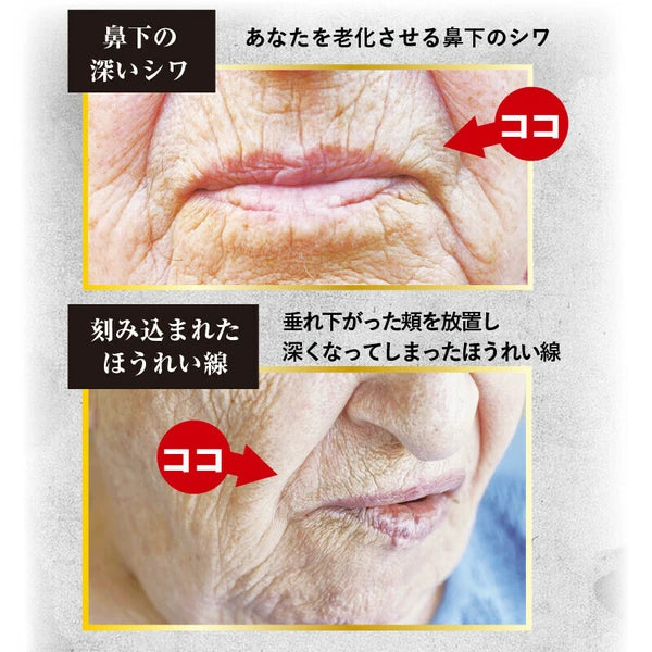 日本JP直送 Quick Young 高級化妝品精華液,用於細紋、抗衰老皺紋和垂直紋,日夜使用,化妝底霜,美容霜 {10月30截單;預計10-14 工作天發貨}