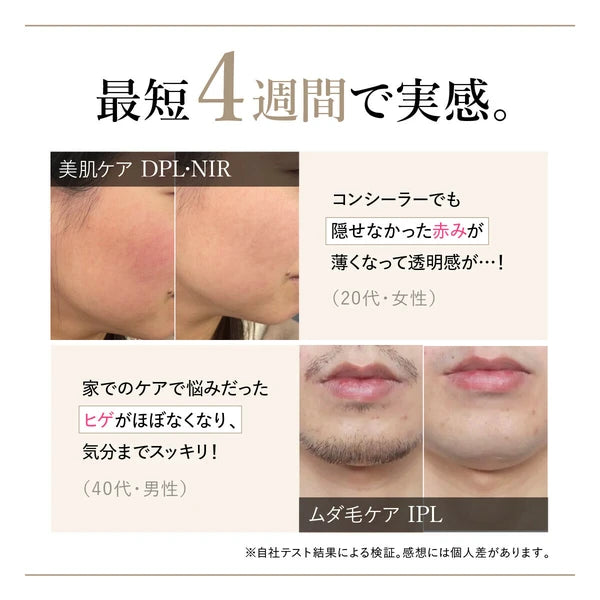 日本JP直送 WAVEWAVE Radiant Grace / 除毛,多餘毛髮護理,IPL,0.1 秒最快 IPL 光子嫩膚治療,自我除毛 {10月30截單;預計10-14 工作天發貨}