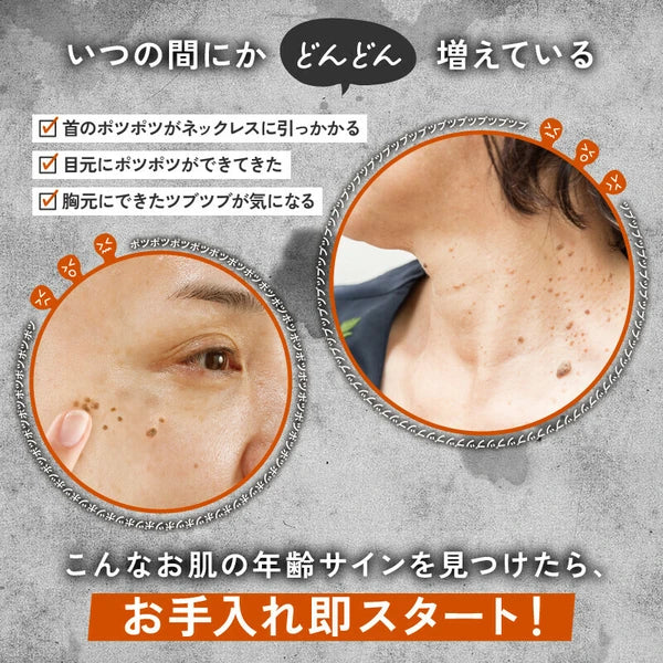 日本JP直送 藥用伊波蘇潤習慣精華液 老年疣 死皮顆粒 胸部斑點 腫塊 眼頸 日本製造 {10月30截單;預計10-14 工作天發貨}