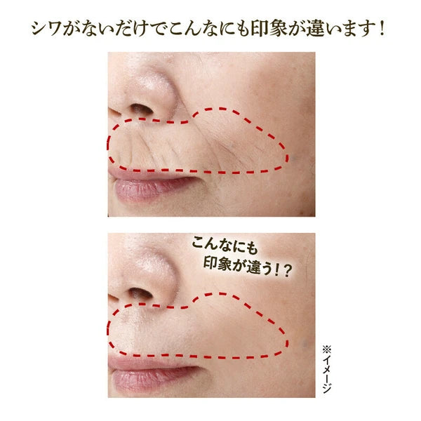 日本JP直送 Quick Young 高級化妝品精華液,用於細紋、抗衰老皺紋和垂直紋,日夜使用,化妝底霜,美容霜 {10月30截單;預計10-14 工作天發貨}