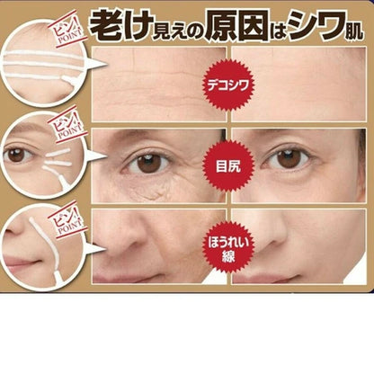 日本JP直送藥用Shiwahar EX 額頭，魚尾紋，法令紋，皺紋，藥用霜，玻尿酸，膠原蛋白  {10月30截單;預計10-14 工作天發貨}