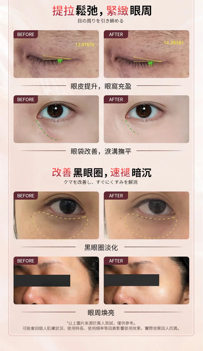 日本JUJY 雙頭全效全眼周逆齡聚能射頻美眼儀 PRO 4.0     {8月2截單;預計10-14 工作天發貨}