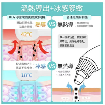 日本JUJY可視冷熱敷黑頭粉刺機|清除黑頭|細／緻毛孔|放大16倍|內置500萬高清攝像頭|不傷膚|香港行貨|    {8月2截單;預計10-14 工作天發貨}
