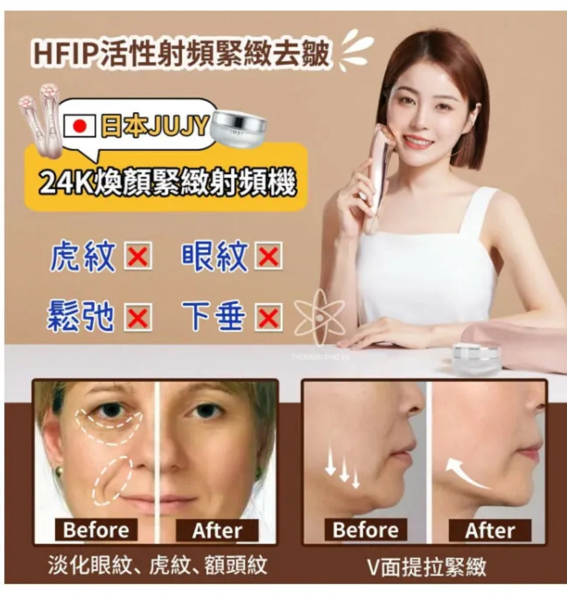 日本直送 JUJY 24K煥顏緊緻射頻機<全新升級> (附送專用精華凝膠)丨緊緻V臉丨回復青春丨撫退皺紋丨鎖水丨日本權威博士推介|限時優惠{2月28截單;預計10-14工作天發貨｝