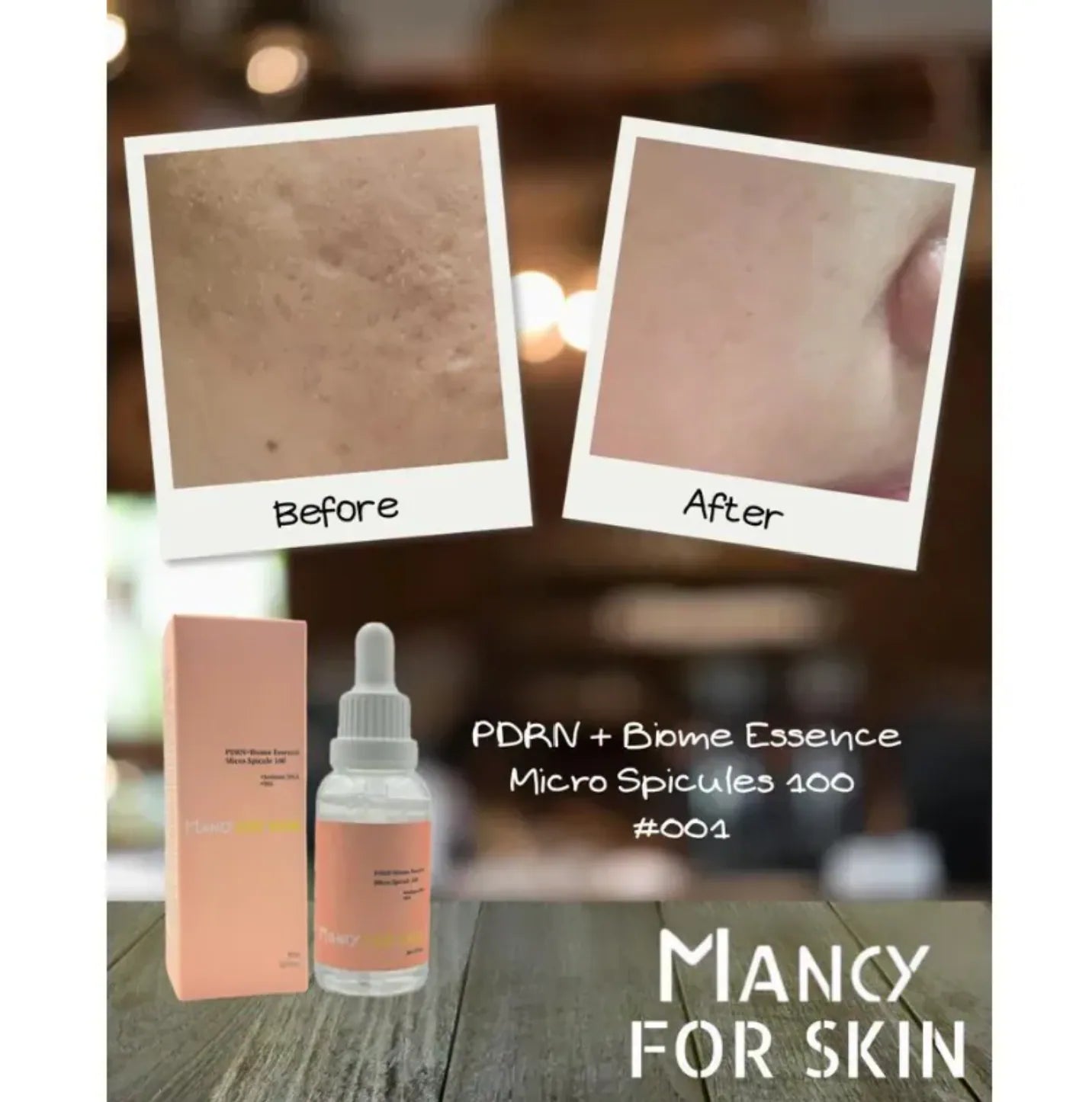 【Mancy For Skin】 精華護膚系列|精華素、精華面膜|強靭肌膚底層至真皮層|深層補水|減少暗沉和抗氧化|舒緩鎖定與抗炎|修護皮膚屏障{6月14截單;預計10-14 工作天發貨}