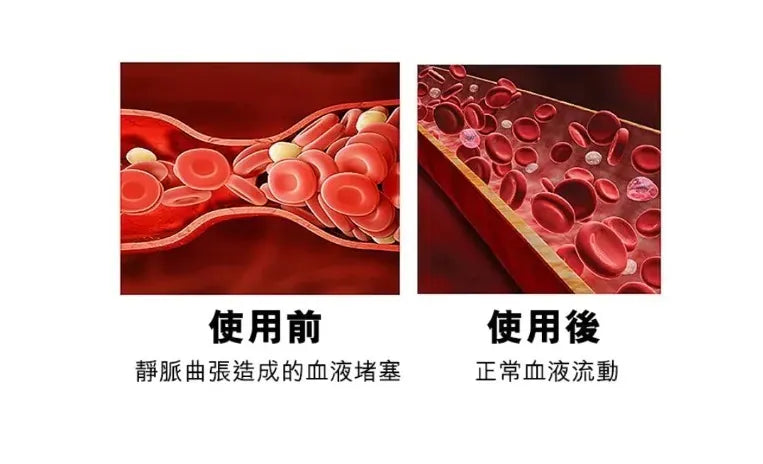 石墨烯手環  {3月15截單;預計10-14 工作天發貨}