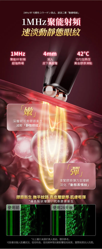 日本JUJY 雙頭全效全眼周逆齡聚能射頻美眼儀 PRO 4.0     {8月2截單;預計10-14 工作天發貨}